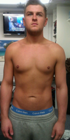 Before image
