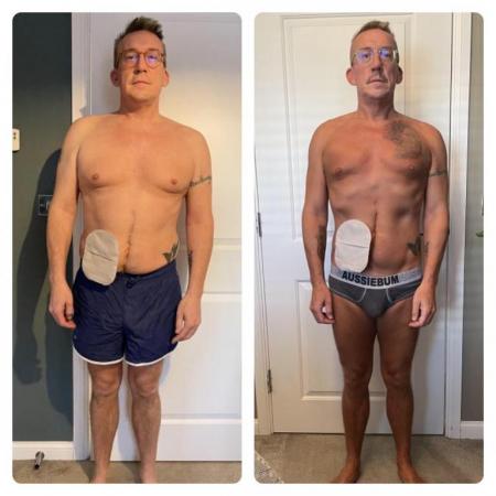 Before and after image